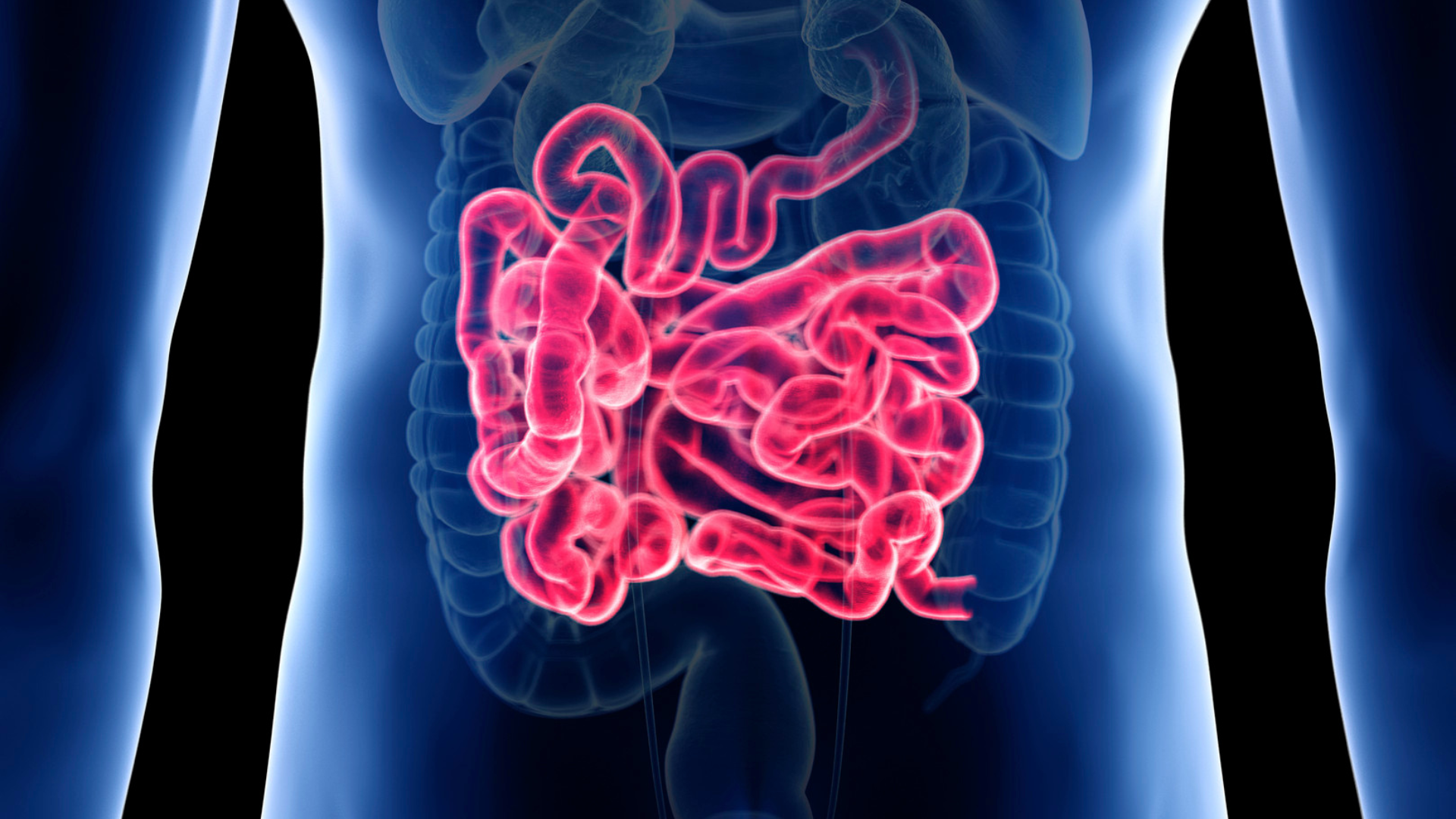 Inflammatory Bowel Disease: Crohn’s Vs Ulcerative Colitis